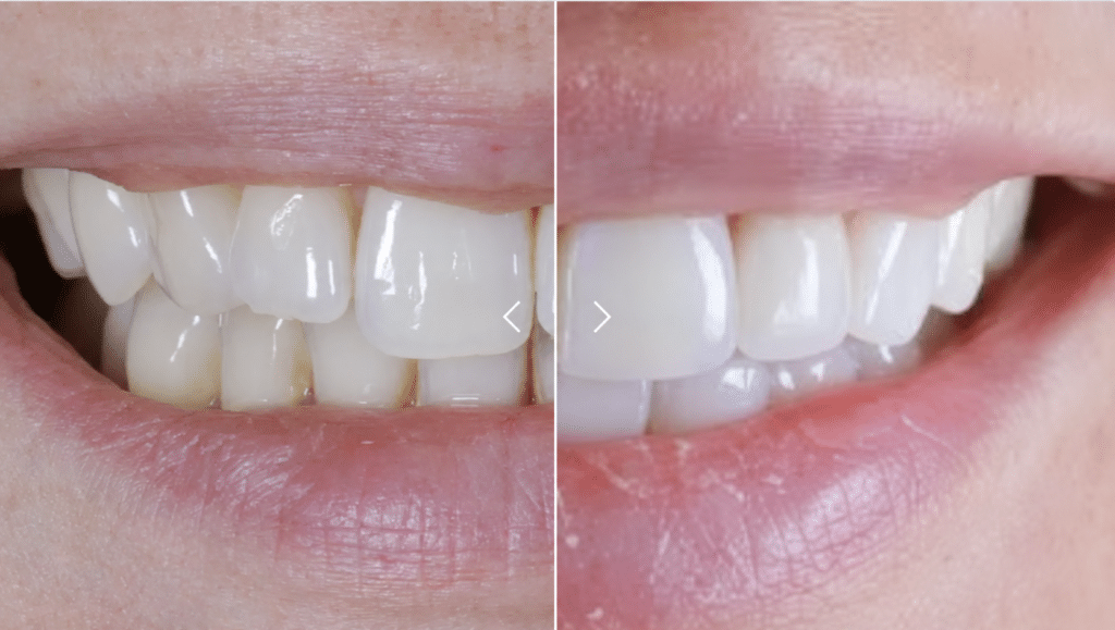 A paired dental comparison
