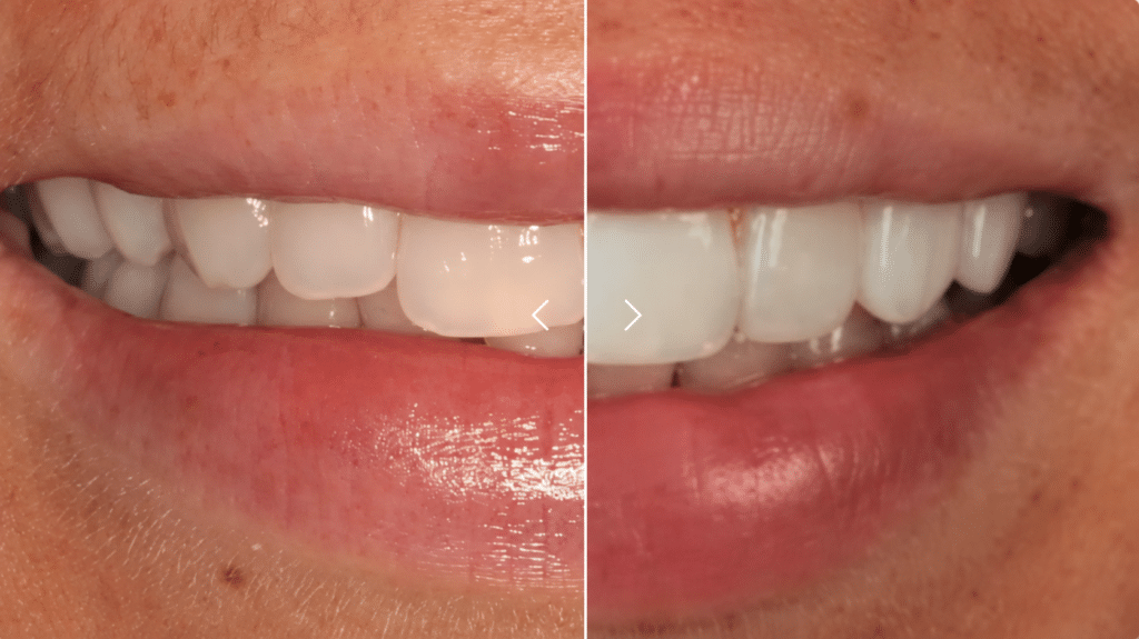 A paired dental comparison